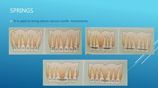 Fixed orthodontic appliances
