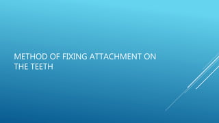 Fixed orthodontic appliances