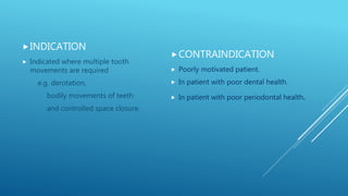 Fixed orthodontic appliances