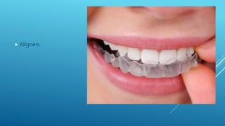 Fixed orthodontic appliances