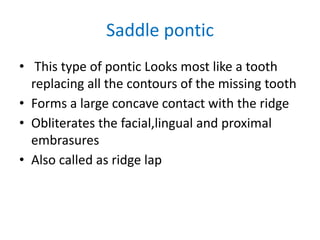Saddle pontic
• This type of pontic Looks most like a tooth
replacing all the contours of the missing tooth
• Forms a large concave contact with the ridge
• Obliterates the facial,lingual and proximal
embrasures
• Also called as ridge lap
 