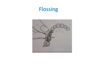 Flossing
 