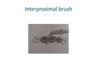 Interproximal brush
 