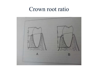 Crown root ratio
 