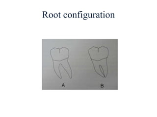 Root configuration
 