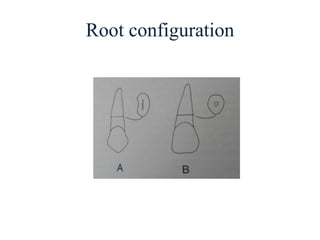 Root configuration
 