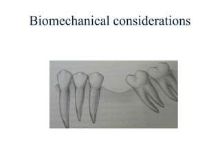 Biomechanical considerations
 