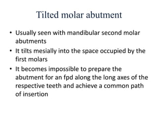 Tilted molar abutment
• Usually seen with mandibular second molar
abutments
• It tilts mesially into the space occupied by the
first molars
• It becomes impossible to prepare the
abutment for an fpd along the long axes of the
respective teeth and achieve a common path
of insertion
 