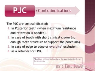 PJC             • Contraindications


The PJC are contraindicated:
 1. in Posterior teeth (when maximum resistance
   and retention is needed).
 2. in case of tooth with short clinical crown (no
   enough tooth structure to support the porcelain).
 3. in case of edge to edge or overbite* occlusion.
 4. as a retainer for FPD.

                   *Overbite: is the vertical overlap of the upper incisor teeth over
                   the lower ones.
 