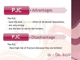 PJC               • Advantages
 The PJC:
1. have the best cosmetic effect of all dental restorations.
2. are very strong.
3. are the best to use on the incisors.



     PJC               • Disadvantage
 The PJC:
   Have high risk of fracture (because they are brittle)!
 