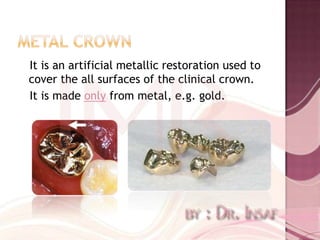It is an artificial metallic restoration used to
cover the all surfaces of the clinical crown.
It is made only from metal, e.g. gold.
 