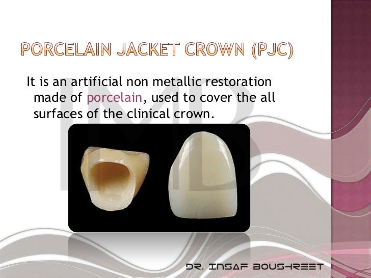 Fixed prosthodontics lesson 3