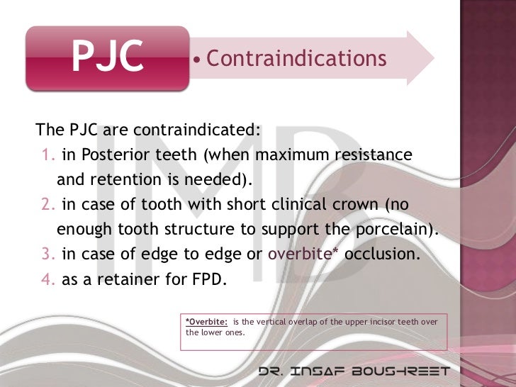 Fixed prosthodontics lesson 3