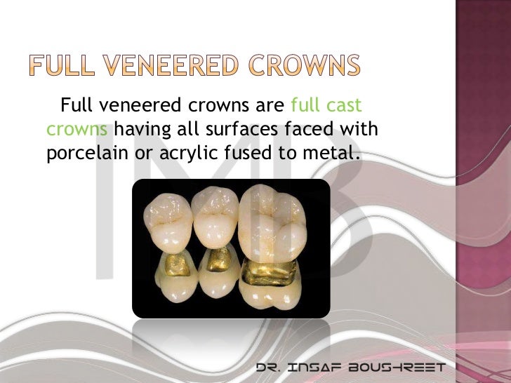 Fixed prosthodontics lesson 3