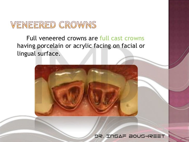 Fixed prosthodontics lesson 3