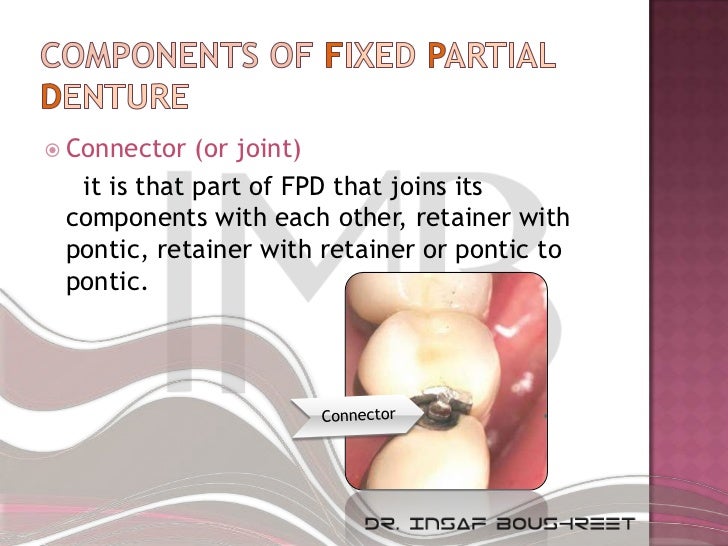 Fixed prosthodontics lesson 5
