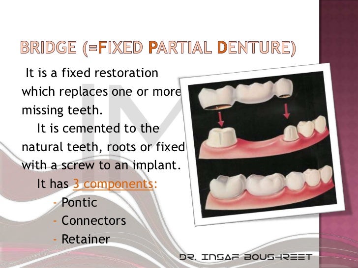 Fixed prosthodontics lesson 5