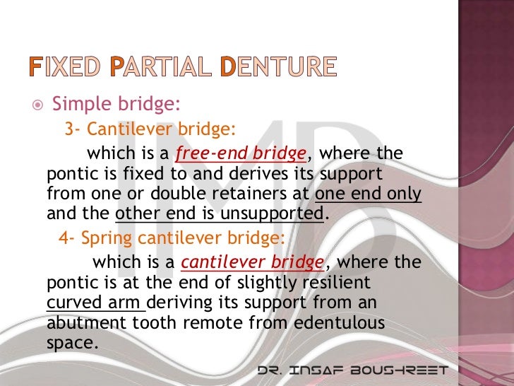 Cantilever Bridge Dental Slideshare - Fixed Prosthodontics Crown Bridge Ppt Video Online Download - Achieveressays.com is the one place where you find help for all types of assignments.
