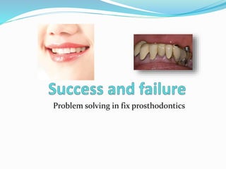 Problem solving in fix prosthodontics
 