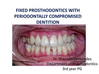 FIXED PROSTHODONTICS WITH
PERIODONTALLY COMPROMISED
DENTITION
Dr. Shannon Fernandes
Department of Prosthodontics
3rd year PG
 