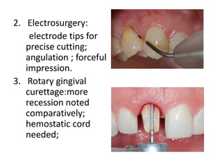 2. Electrosurgery:
electrode tips for
precise cutting;
angulation ; forceful
impression.
3. Rotary gingival
curettage:more
recession noted
comparatively;
hemostatic cord
needed;
 