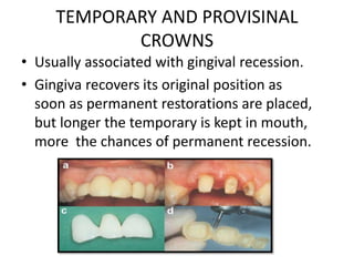 TEMPORARY AND PROVISINAL
CROWNS
• Usually associated with gingival recession.
• Gingiva recovers its original position as
soon as permanent restorations are placed,
but longer the temporary is kept in mouth,
more the chances of permanent recession.
 