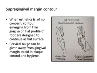 Supragingival margin contour
• When esthetics is of no
concern, contour
emerging from thin
gingiva on flat profile of
root are designed to
continue as flat surface.
• Cervical bulge can be
given away from gingival
margin to aid in plaque
control and hygiene.
 