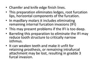 • Chamfer and knife edge finish lines.
• This preparation eliminates ledges, root furcation
lips, horizontal components of the furcation.
• In maxillary molars it includes eliminating
remaining internal furcation invasions (IFI)
• This may present problems if the IFI is too deep.
• Barreling this preparation to eliminate the IFI may
reduce tooth structure to critically narrow
isthmus.
• It can weaken teeth and make it unfit for
retaining prosthesis, or remaining intrafurcal
attachment may be lost, resulting in gradde 3
furcal invasion.
 