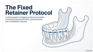 Fixed Retention Fixed Retainers Explained: The Complete Retention Protocol | PPTX