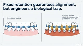 Fixed Retention Fixed Retainers Explained: The Complete Retention Protocol | PPTX