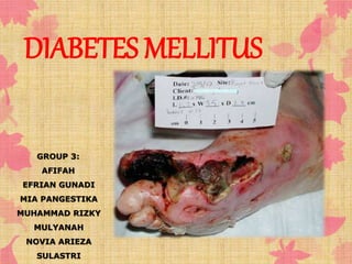 DIABETES MELLITUS 
GROUP 3: 
AFIFAH 
EFRIAN GUNADI 
MIA PANGESTIKA 
MUHAMMAD RIZKY 
MULYANAH 
NOVIA ARIEZA 
SULASTRI 
 