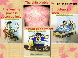 Impotence in 
men 
the healing 
process 
becomes long. 
The skin problems. 
visual impairment 
OTHER SYMPTOMS 
 