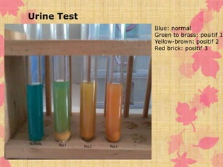 Blue: normal 
Green to brass: positif 1 
Yellow-brown: positif 2 
Red brick: positif 3 
Urine Test 
 