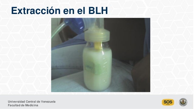 Bancos de leche humana en Venezuela Garantía de vida. MSc 