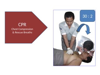 BASIC LIFE SUPPORT CPR MANAGEMENT RES.pptx