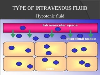Type of inTravenous fluid 
Hypotonic fluid 
 