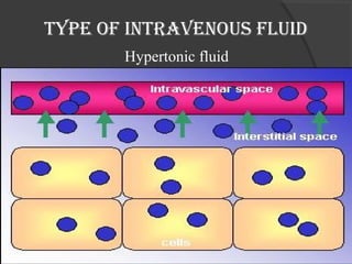 Type of inTravenous fluid 
Hypertonic fluid 
 