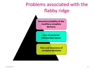 Journal club on Management of flabby ridges | PPTX