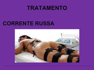 TRATAMENTO
CORRENTE RUSSA
 