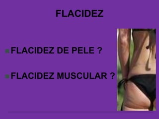 FLACIDEZ
 FLACIDEZ DE PELE ?
 FLACIDEZ MUSCULAR ?
 