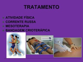 TRATAMENTO
 ATIVIDADE FÍSICA
 CORRENTE RUSSA
 MESOTERAPIA
 BANDAGEM CRIOTERÁPICA
 