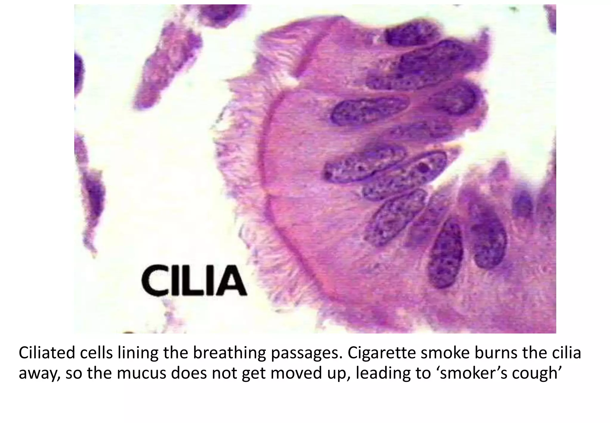 Ciliated cells lining the breathing passages. Cigarette smoke burns the cilia
away, so the mucus does not get moved up, leading to ‘smoker’s cough’