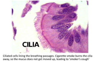 Ciliated cells lining the breathing passages. Cigarette smoke burns the cilia
away, so the mucus does not get moved up, leading to ‘smoker’s cough’
 