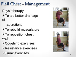 Flail Chest – ManagementFlail Chest – Management
Physiotherapy
To aid better drainage
of
secretions
To rebuild musculature
To reposition chest
wall
Coughing exercises
Resistance exercises
Trunk exercises
 