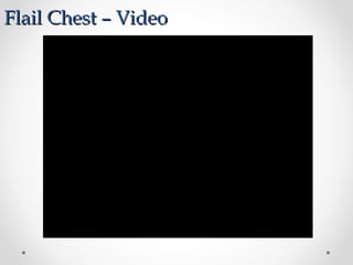 Flail Chest – VideoFlail Chest – Video
 