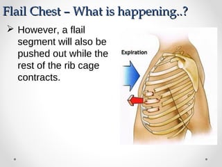  However, a flail
segment will also be
pushed out while the
rest of the rib cage
contracts.
Flail Chest – What is happening..?Flail Chest – What is happening..?
 