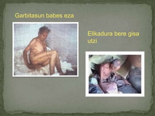 Garbitasun babes ezaElikadura bere gisa utzi