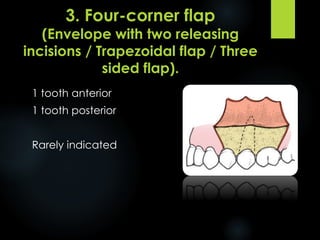 Trapezoidal Incision Flap Design for Minor Oral Surgery | PDF
