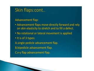 Slow Flap Flap and its classification | PPTX