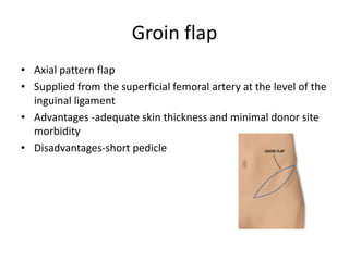 Groin flap
• Axial pattern flap
• Supplied from the superficial femoral artery at the level of the
inguinal ligament
• Advantages -adequate skin thickness and minimal donor site
morbidity
• Disadvantages-short pedicle
 